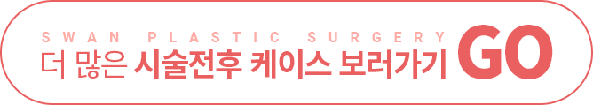 더 많은 시술전후 케이스 보러가기