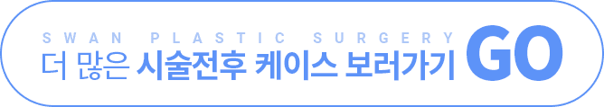 더 많은 시술전후 케이스 보러가기