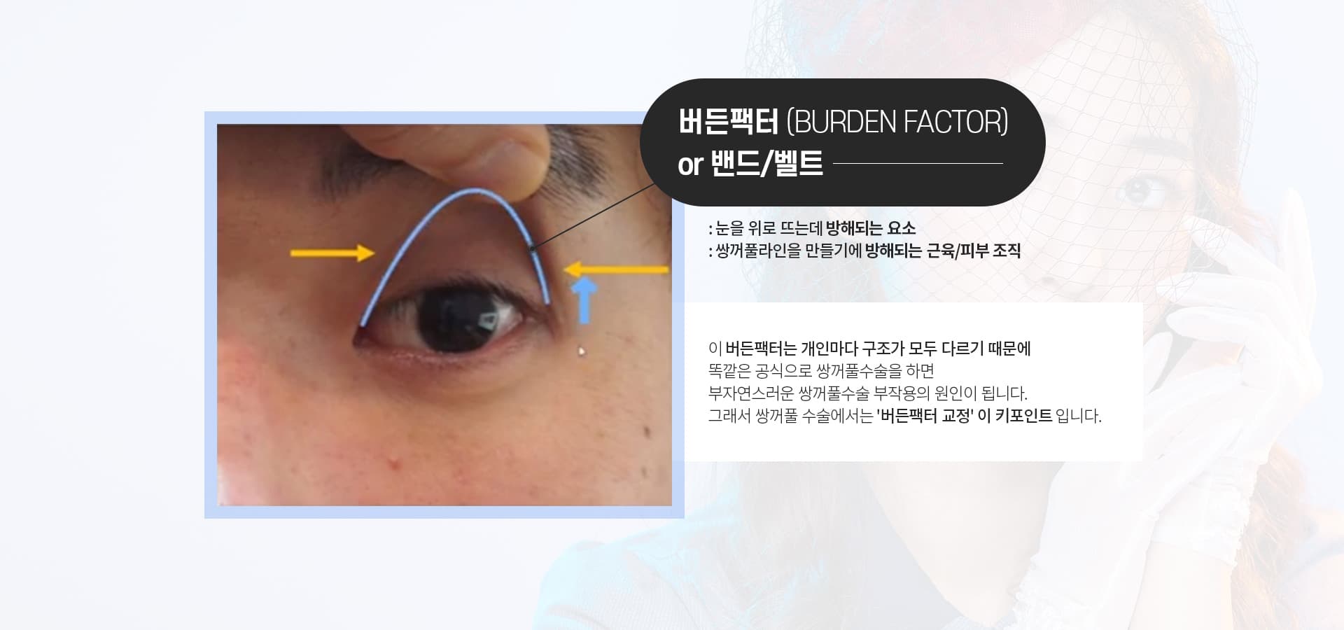 버든팩터(BURDEN FACTOR)