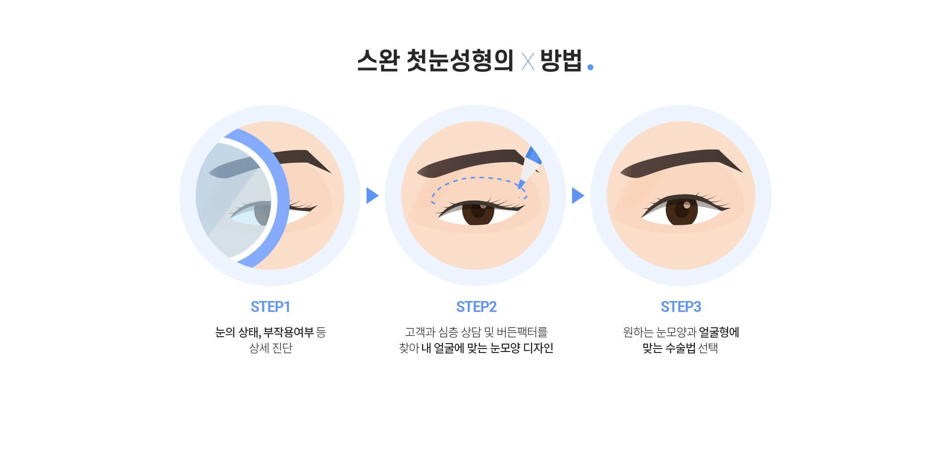 스완 첫눈성형의×방법