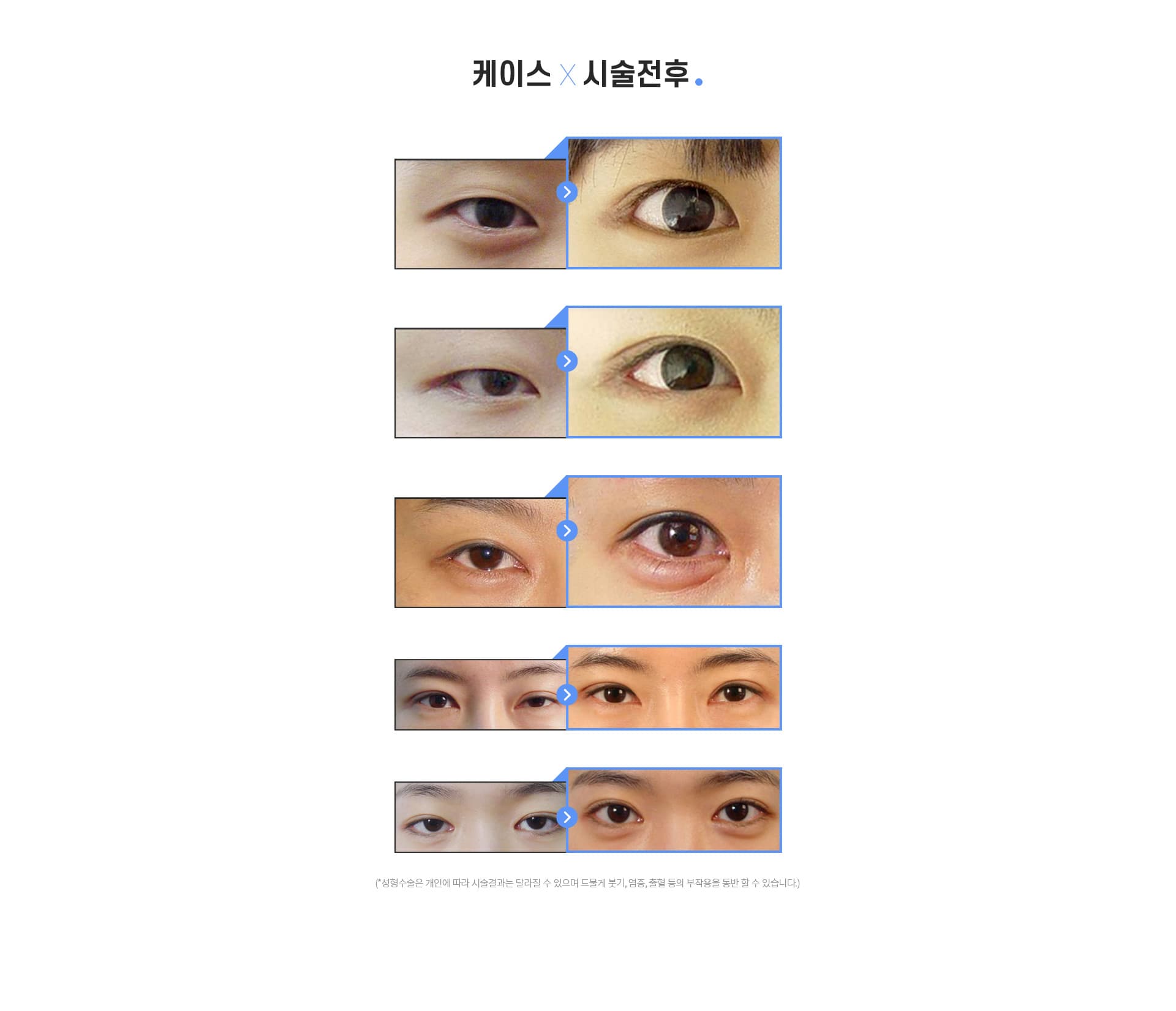 케이스×시술전후