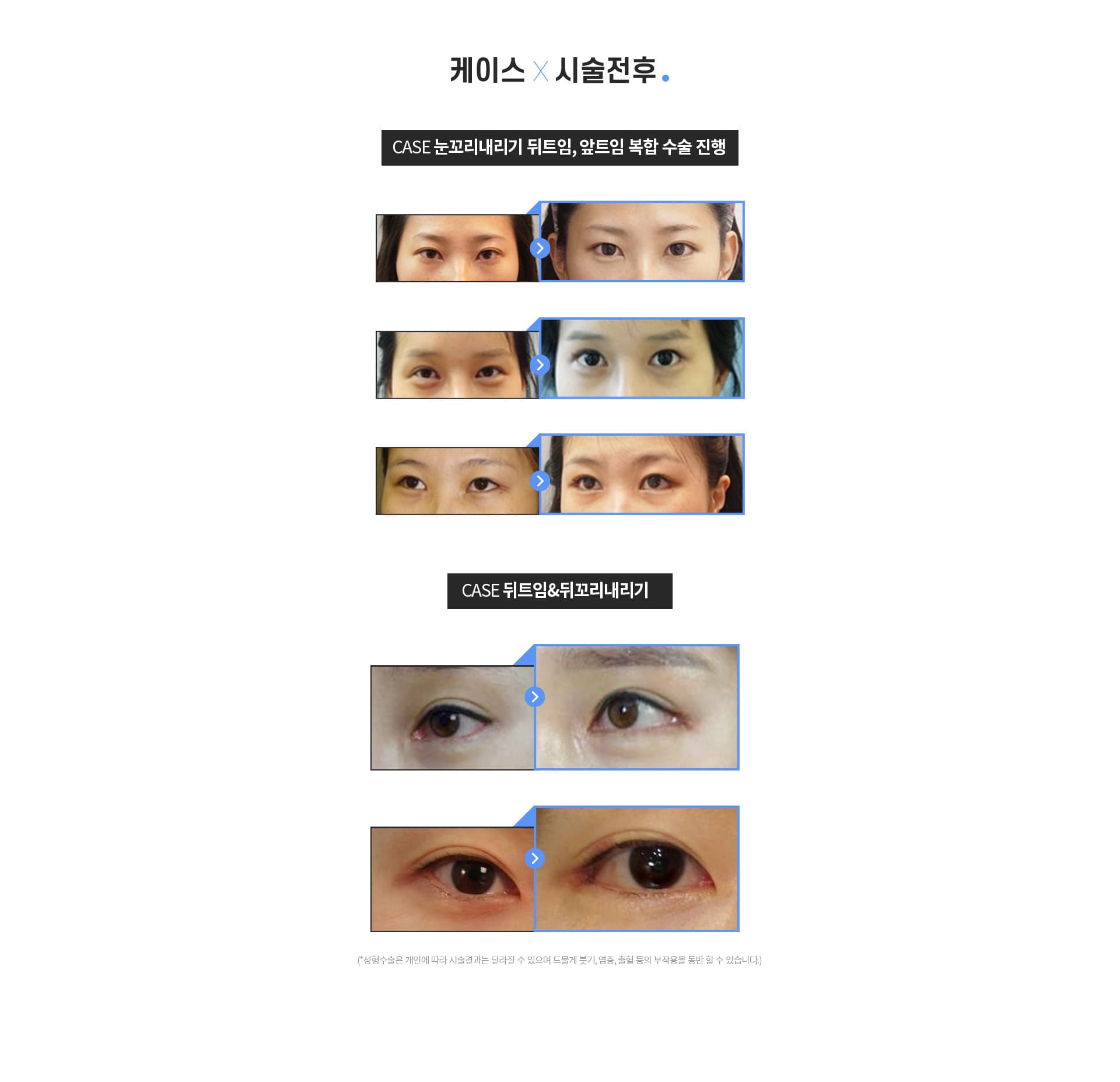 케이스 ×시술전후