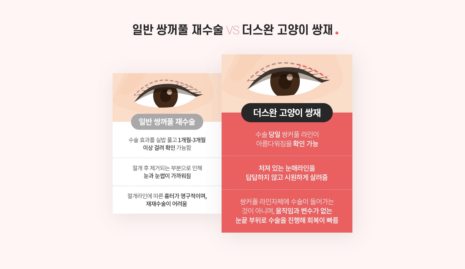 일반 쌍꺼풀 재수술 VS더스완 고양이 쌍재