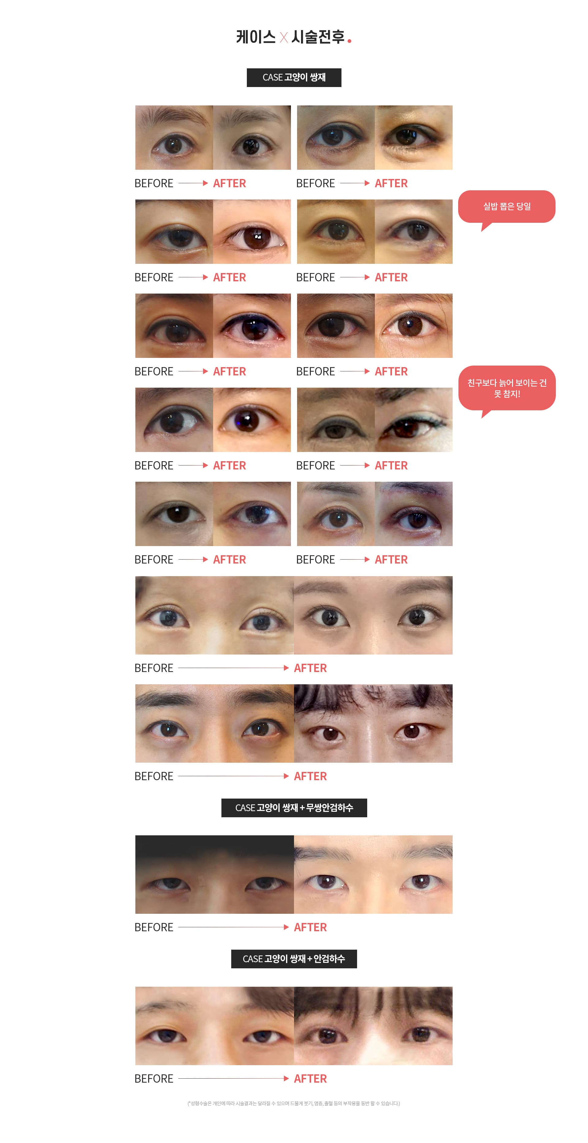 CASE고양이 쌍재+무쌍안검하수