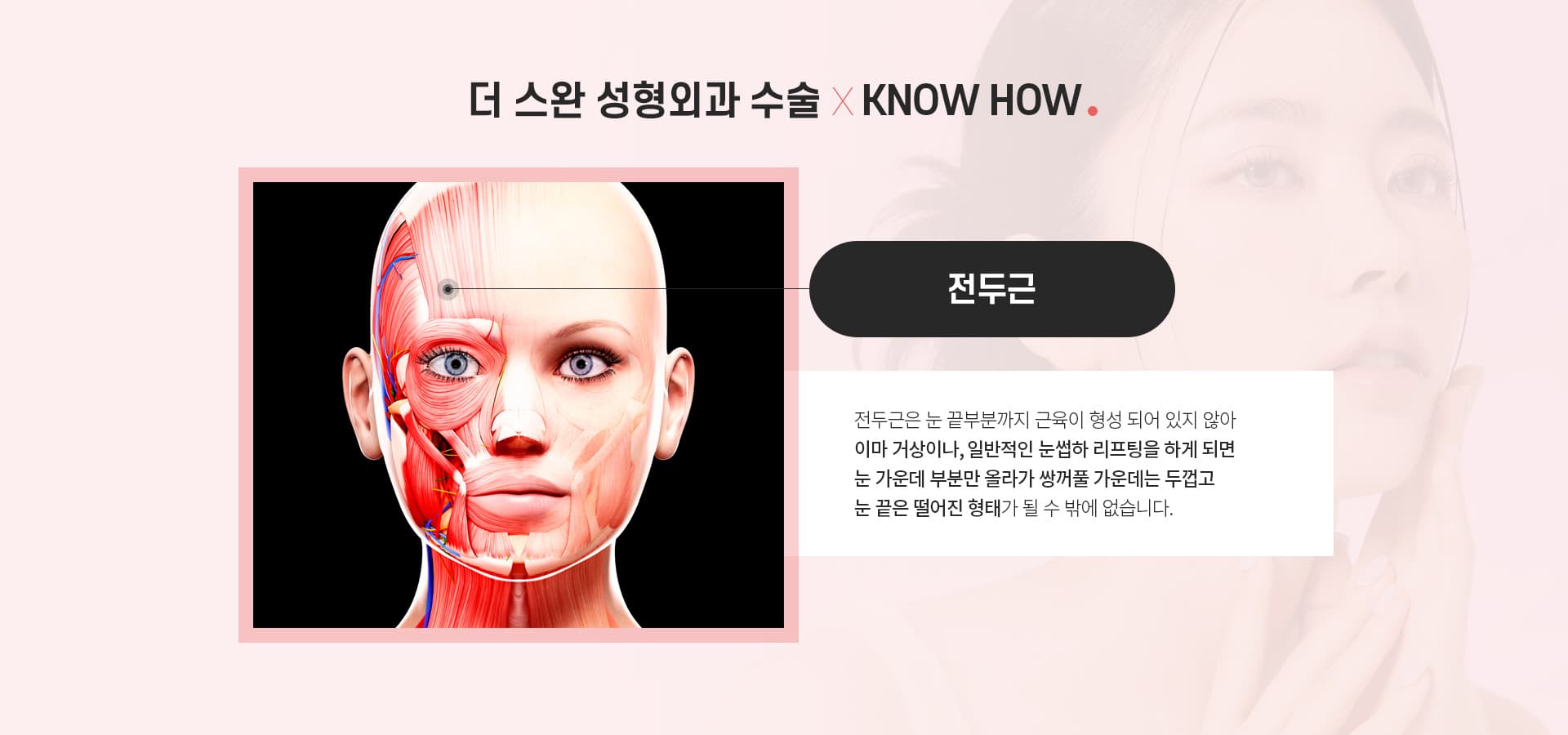 더스완 성형외과 수술×KNOWHOW.