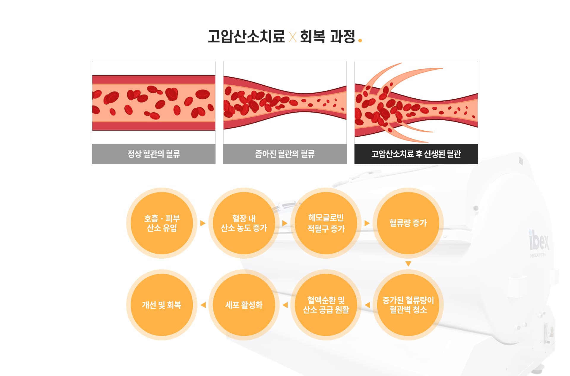 고압산소치료×회복 과정