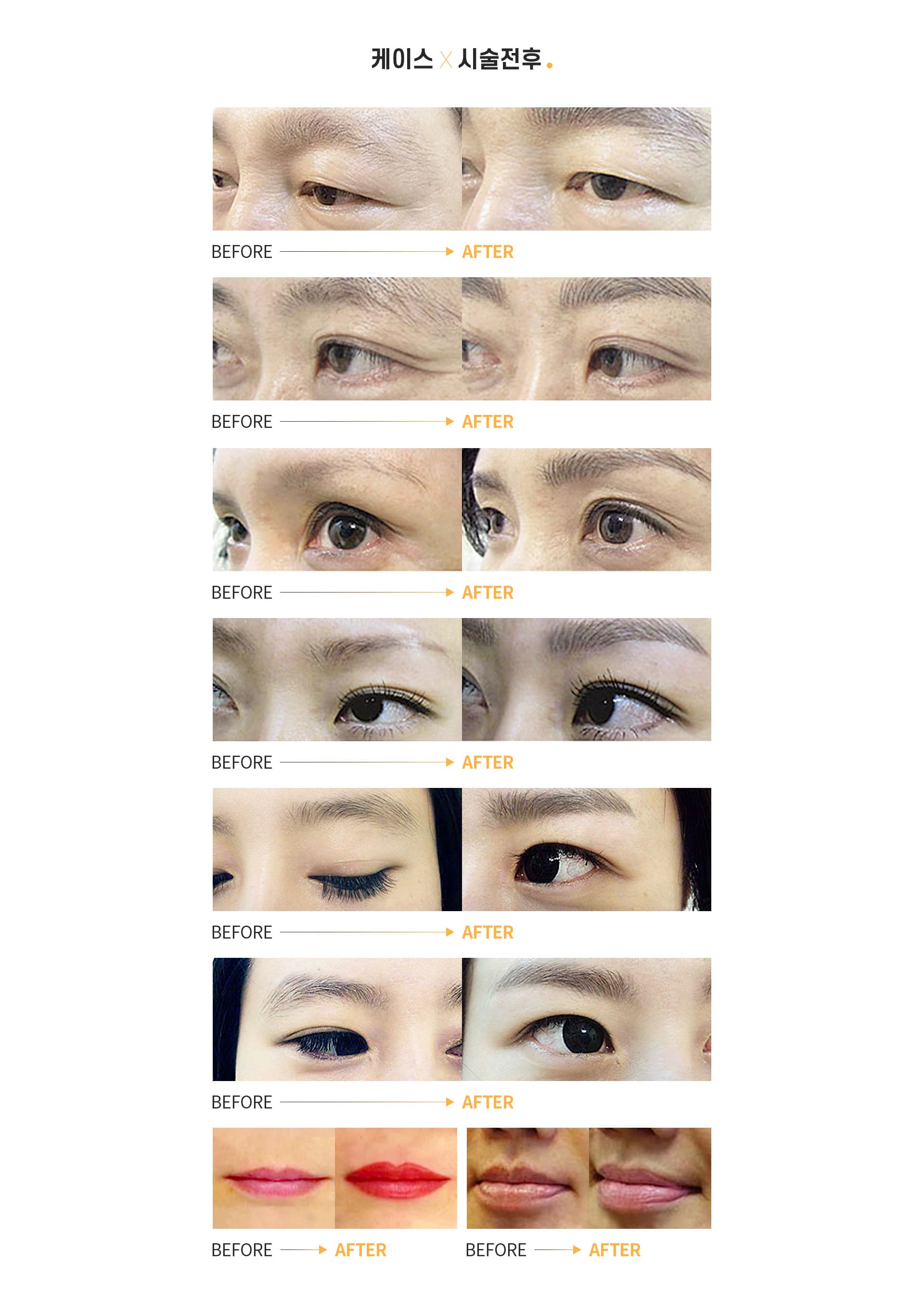 BEFORE →AFTER