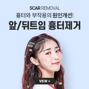 앞뒤트임 흉터 제거