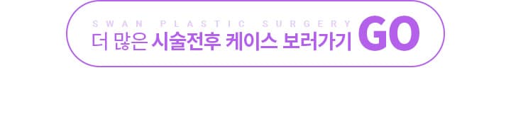 더 많은 시술전후 케이스 보러가기