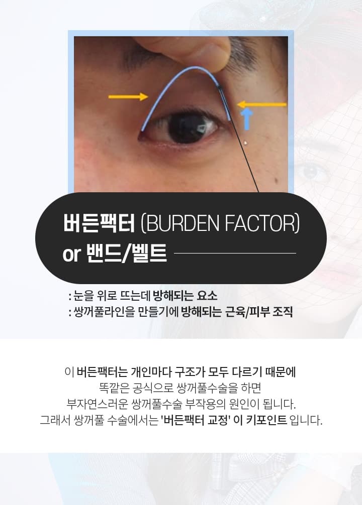 버든팩터(BURDEN FACTOR)