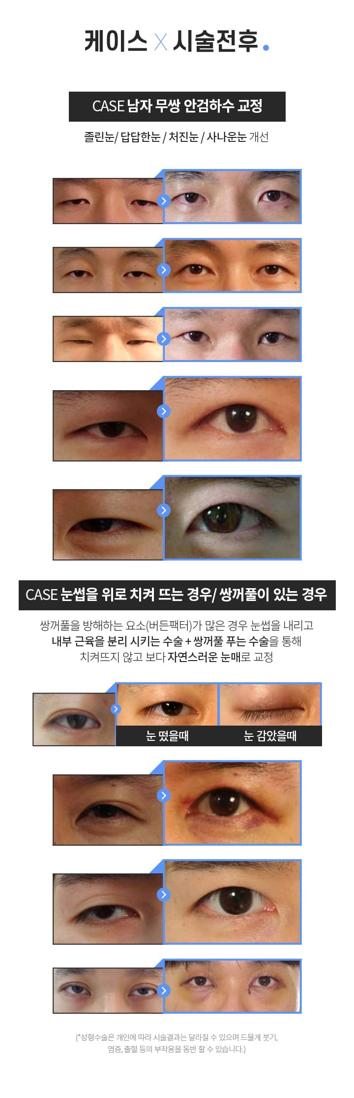 케이스×시술전후