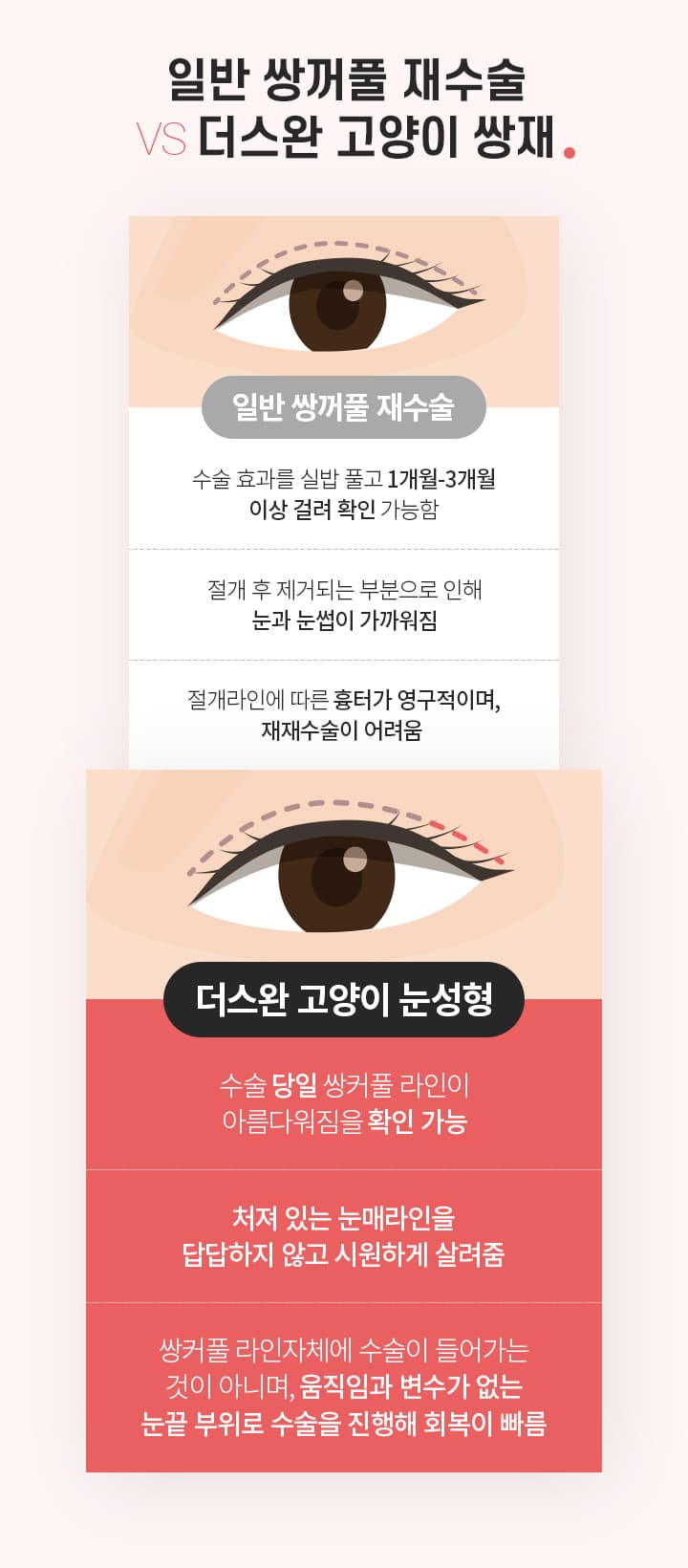 일반 쌍꺼풀 재수술 VS더스완 고양이 쌍재