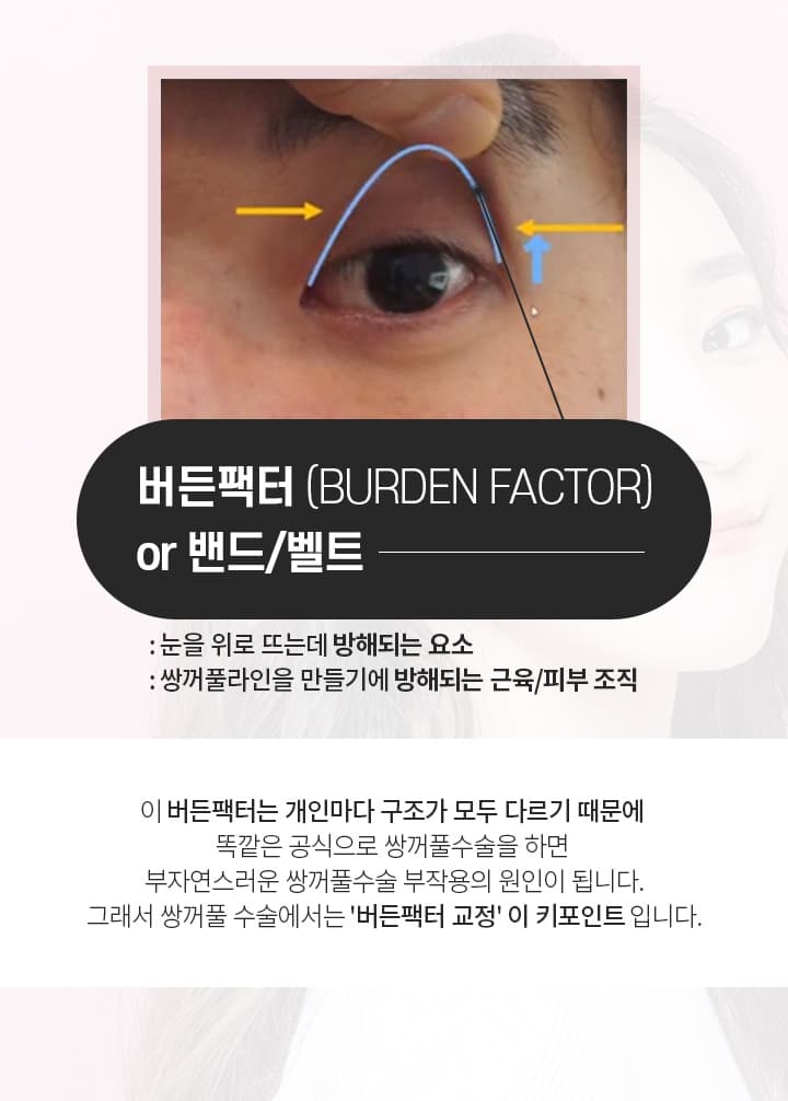 버든팩터(BURDEN FACTOR)