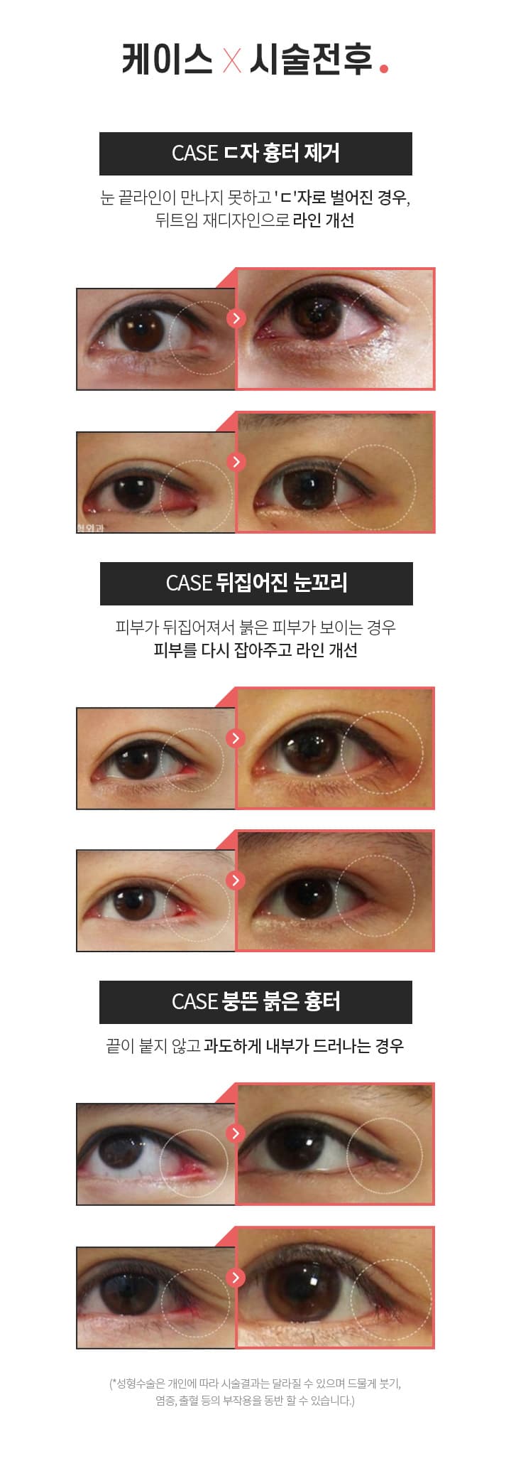 케이스×시술전후
