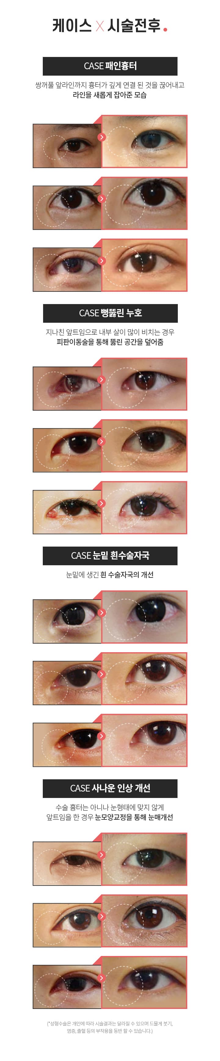 케이스×시술전후