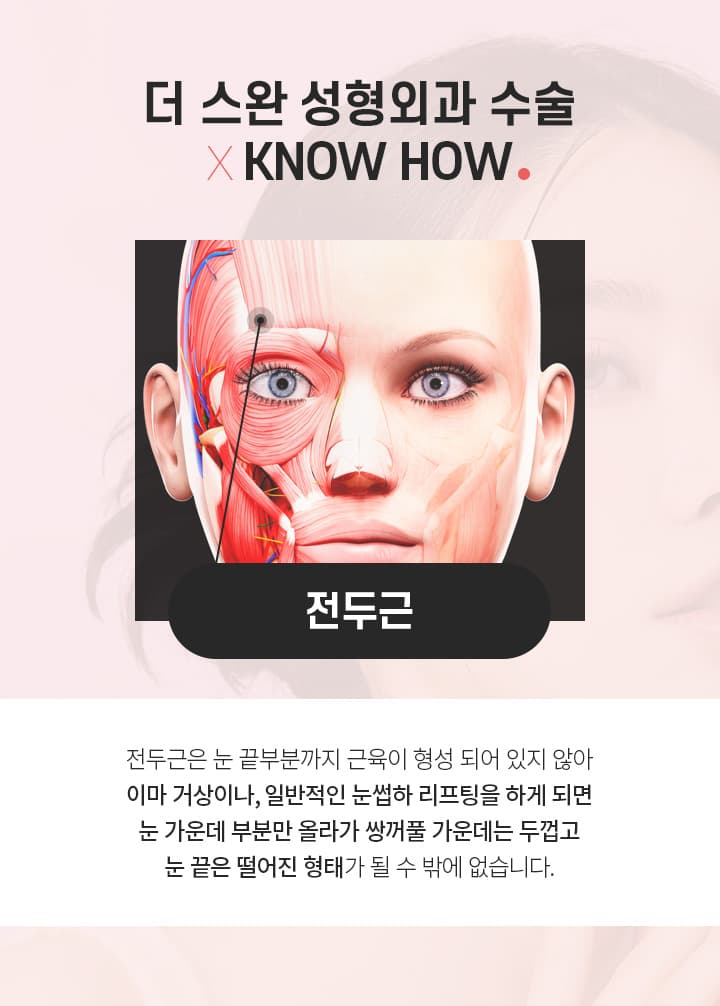 더스완 성형외과 수술×KNOWHOW.