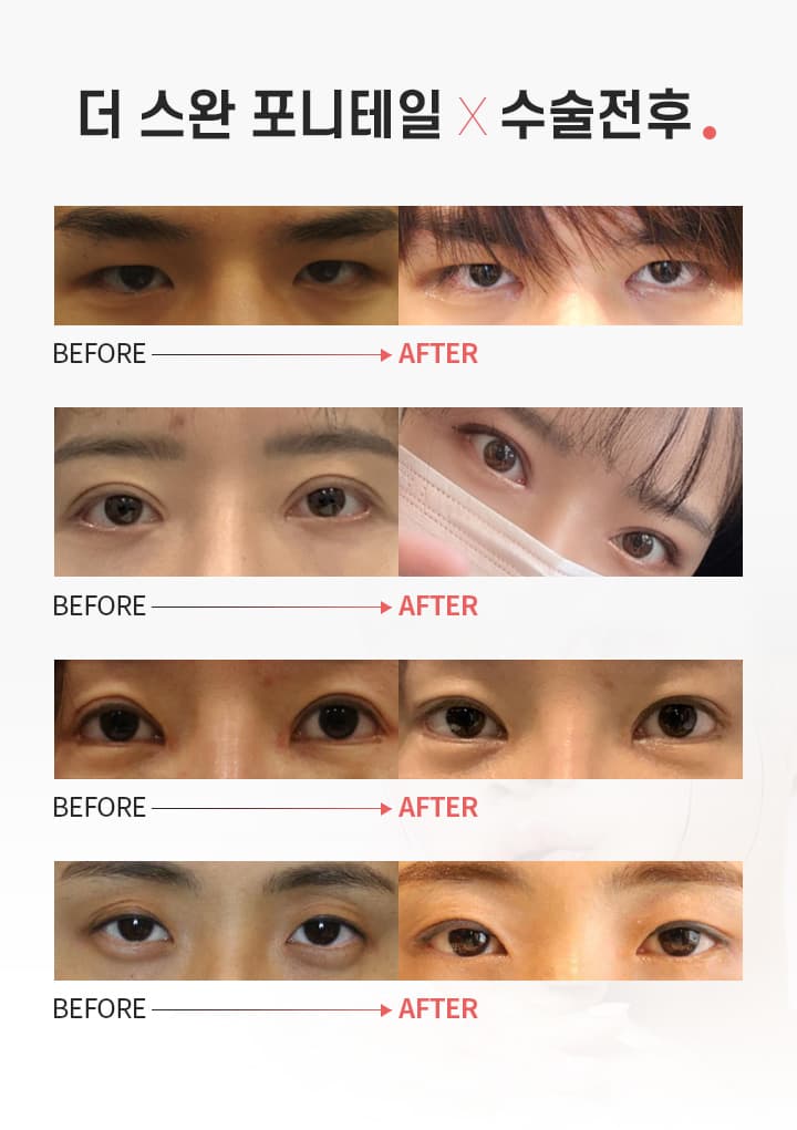 BEFORE →AFTER