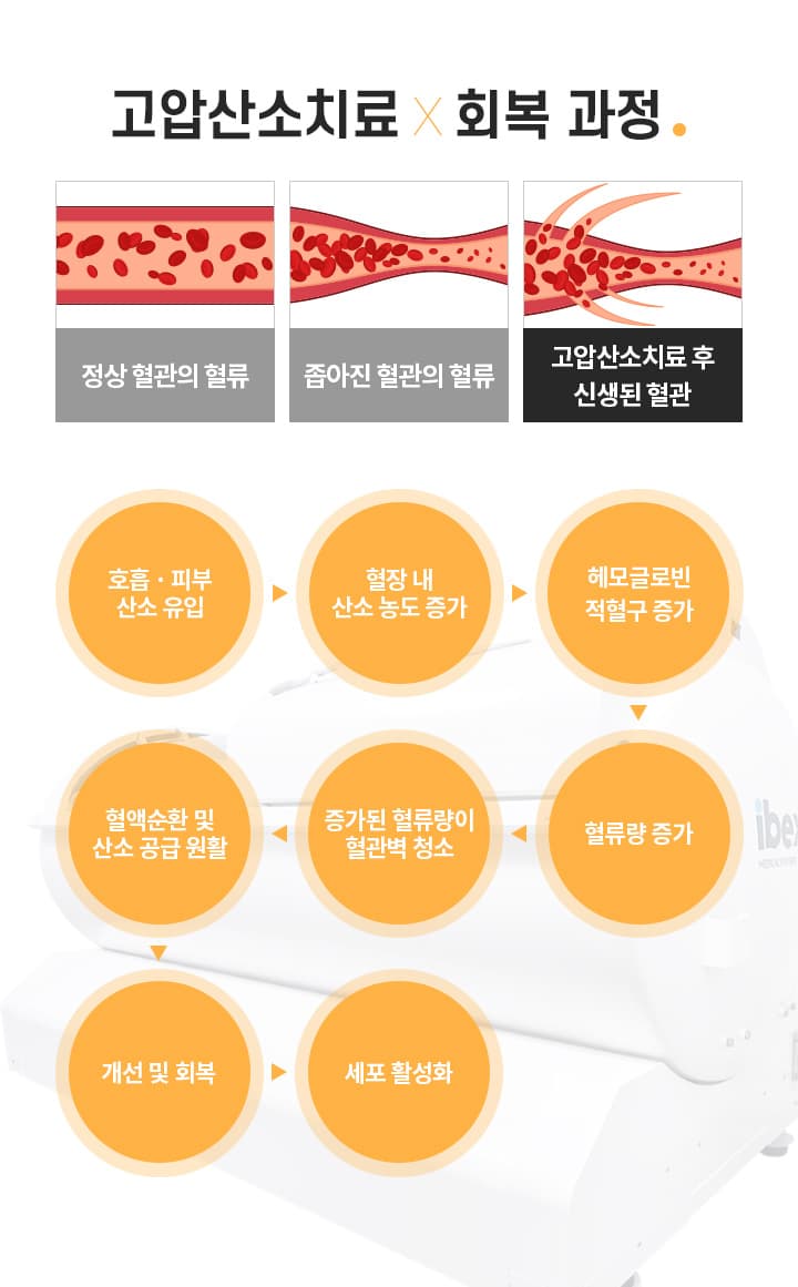 고압산소치료×회복 과정